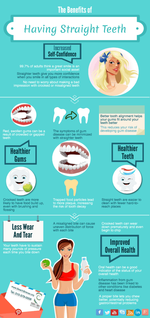 The Benefits of Having Straight Teeth - Beach Braces - Orthodontic ...